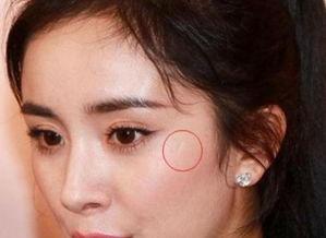 明星疤痕图片,揭秘明星疤痕背后的心酸历程